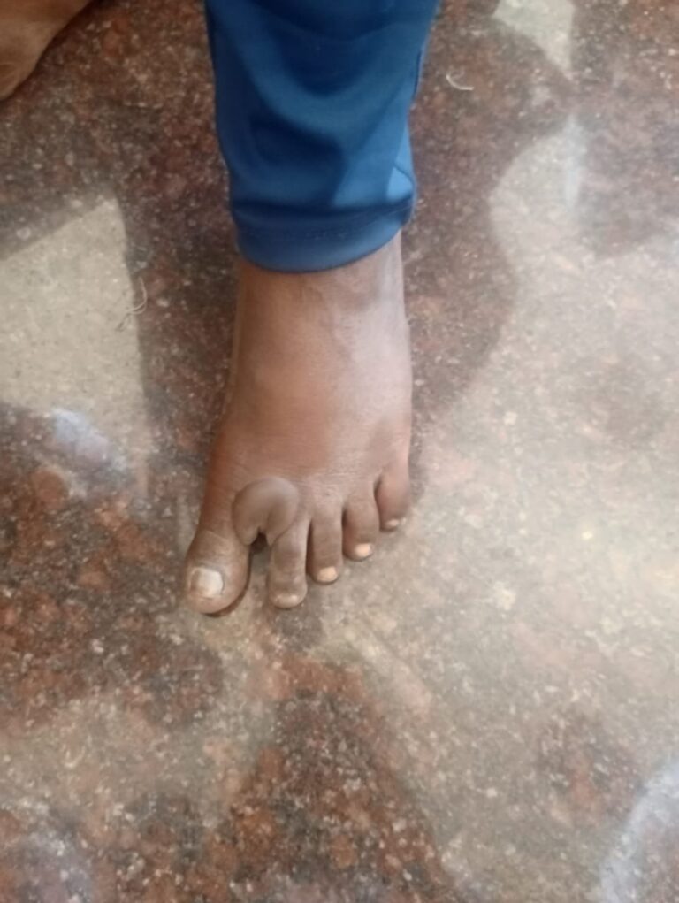 ಬೊಬ್ಬೆ ಬಂದರೂ ಬಿಡದ ವಕೀಲರ ಪಾದಯಾತ್ರೆ